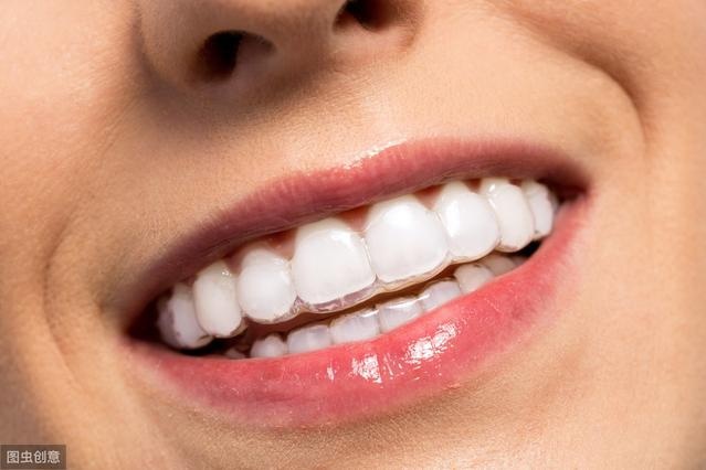 戴隐形牙套矫正牙齿时间会更长吗?
