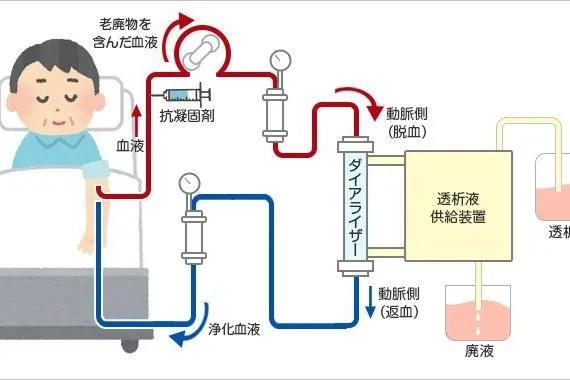 美日健康|预防性血液净化