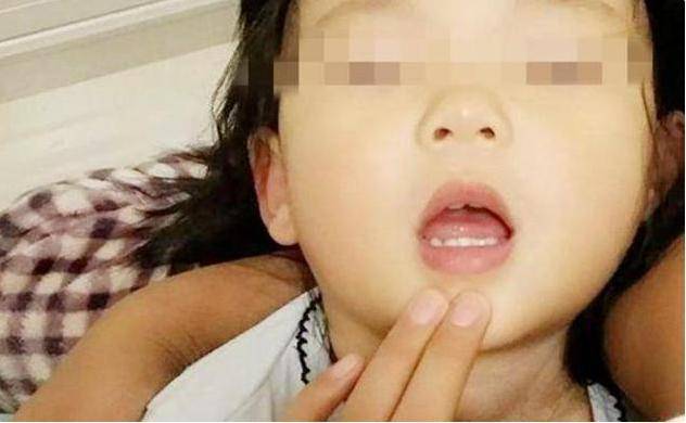 【反应】宝妈的反应很迅速，医生：书没白读3岁女儿被鱼刺卡住喉咙