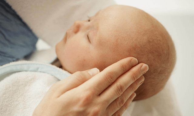 「孩子头」记住这几点宝宝睡觉什么睡姿好？想要孩子头型好看