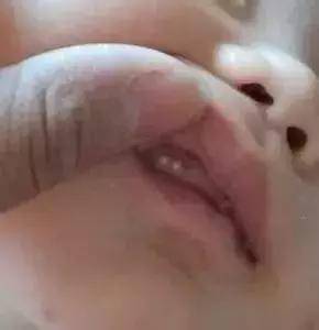 #宝宝#只因奶奶太疼爱！这6大育儿坑，简直坑坑要命！婴儿差点截肢