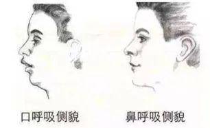 「牙齿」千万别错过！否则毁掉孩子一口好牙牙齿三个 “关键期”