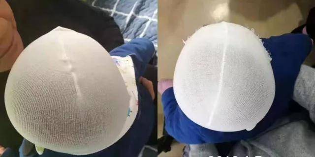 『孩子』宝妈别傻傻不知道婴儿该不该用枕头？如何用枕头有讲究