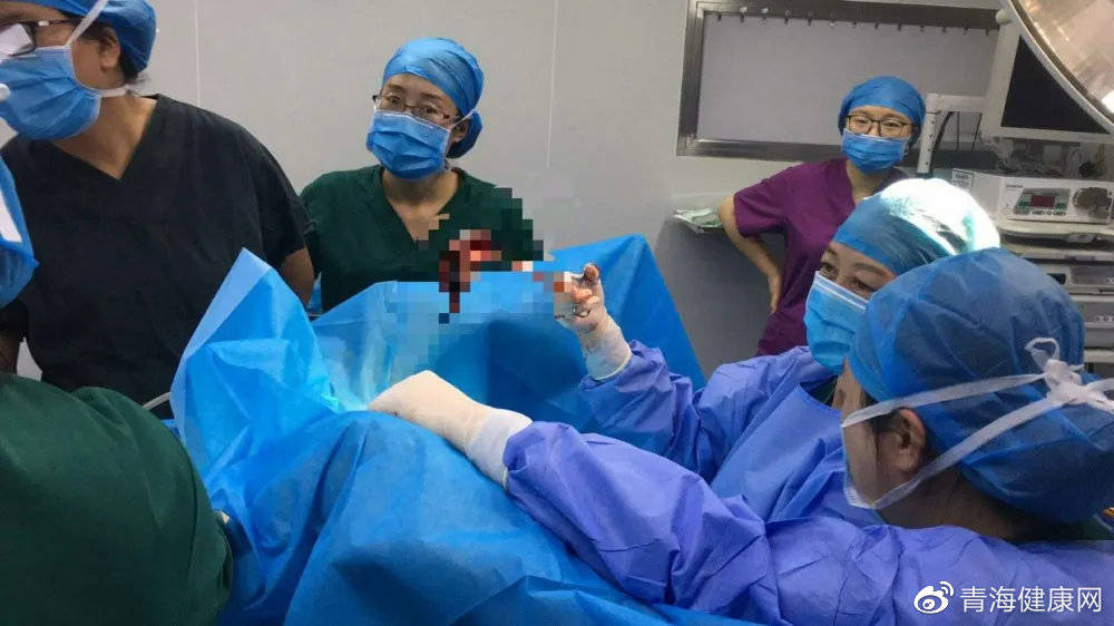 青海省康乐医院:手术麻醉科成功抢救一例稽留流产失血性休克患者