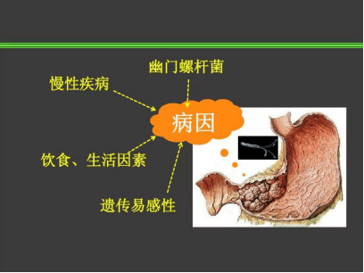 516a887bc1fa487cbffcf67711c6032a.png