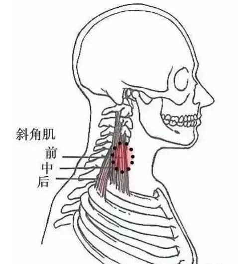 7,项伸肌群和项筋膜压痛点在枕骨和颈椎棘突附着处和原发性损害的