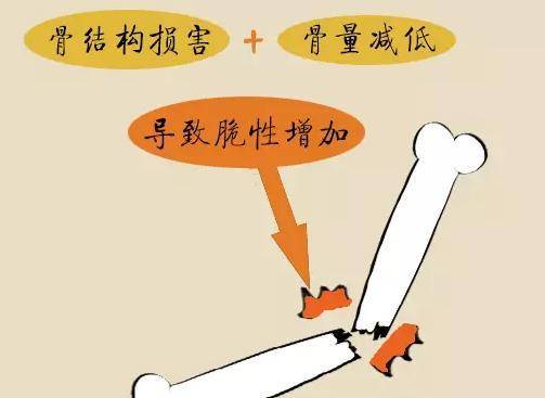 骨质疏松吃什么补得快啊 d9a8156f3b91487c984e14d1b3103acb.jpeg