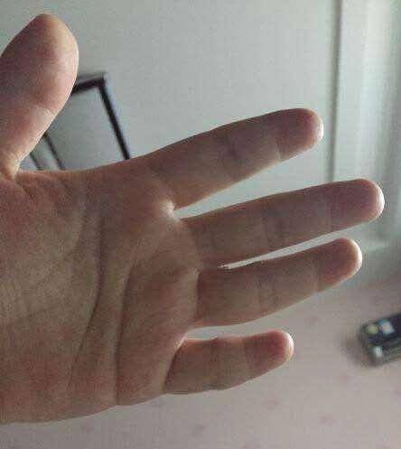 小指什么成语_成语故事图片