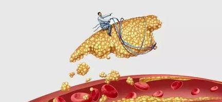 小密度低密度脂蛋白1.98 934a12dbbceb448482b15180fe31ac02.jpeg