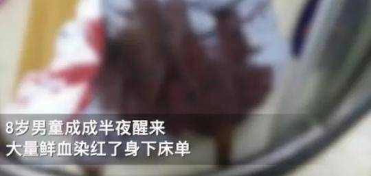 床单：医生：孩子问题是吃出来的，家长要注意8岁男孩半夜血染床单