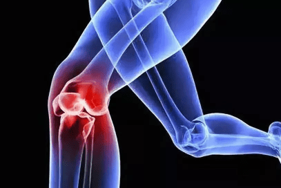 膝盖滑膜炎的症状和表现 fed6d212b0cd4f4dbd22641534058dc8.png