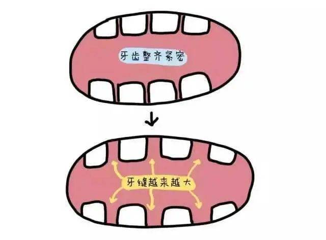 急急急因为牙缝大经常被人嘲笑这牙还有救吗