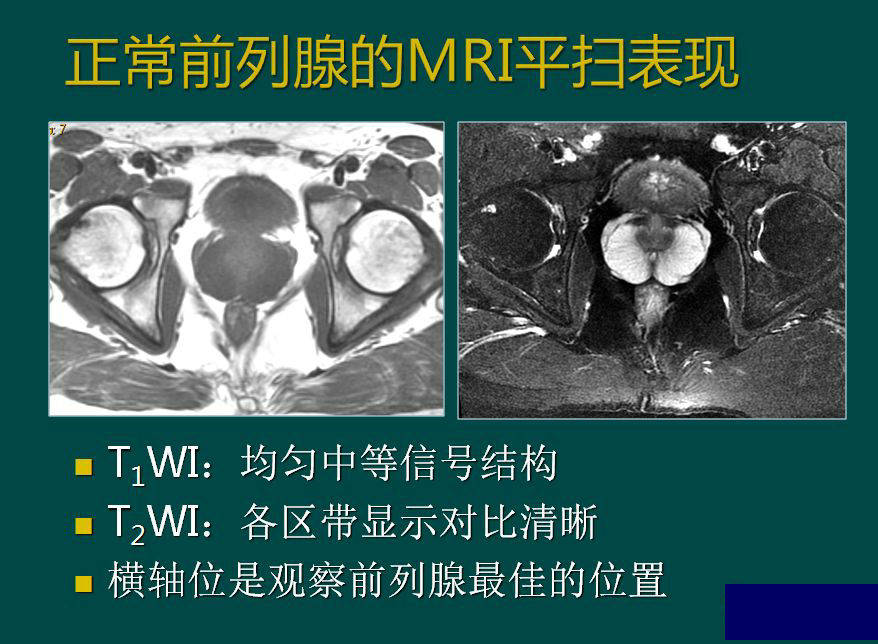 精彩解剖 肾脏,输尿管,膀胱,肾上腺,前列腺