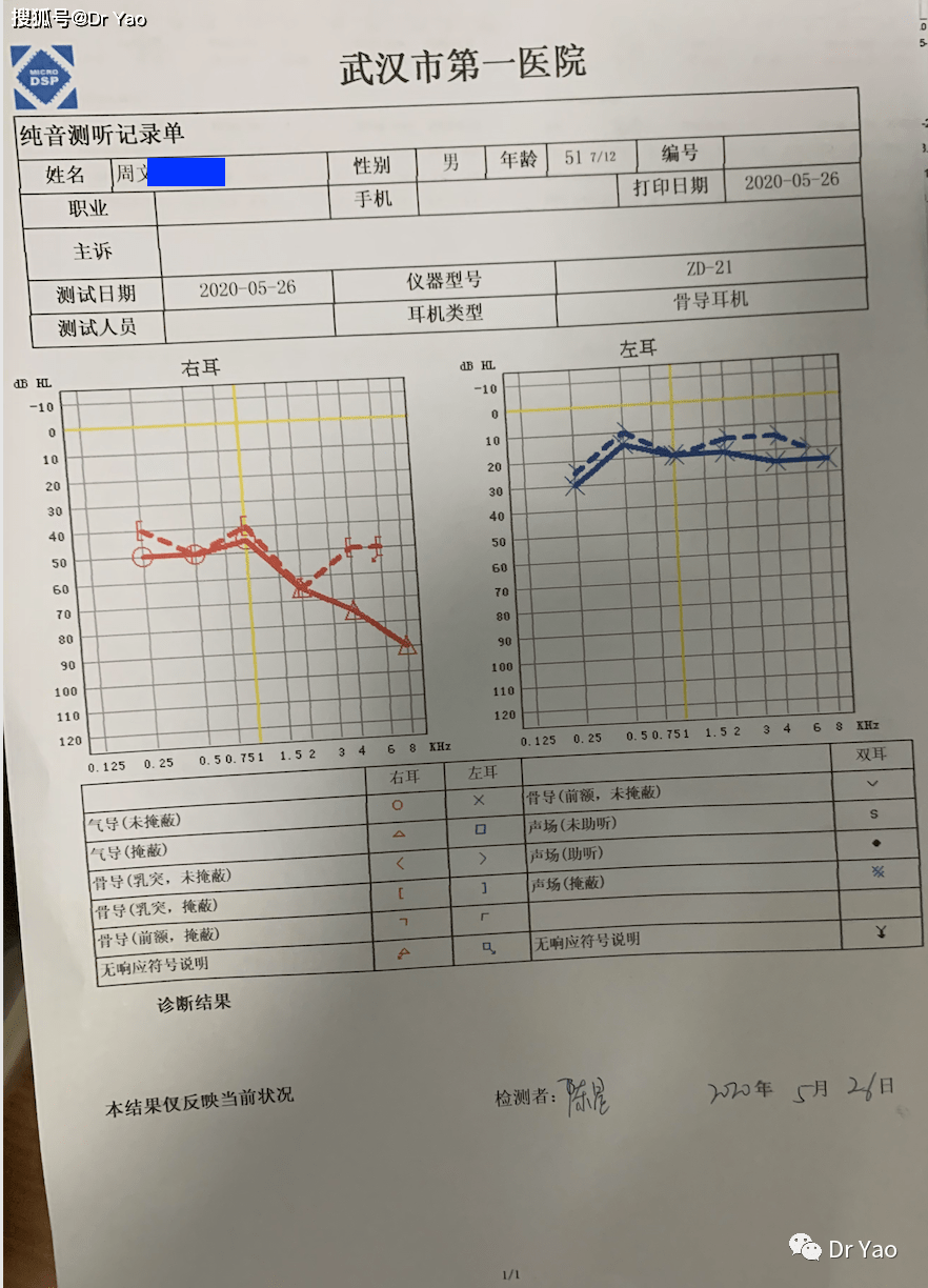 听力依此我为这位患者推荐的是:治疗方案:左耳突发性耳聋:轻度,低频