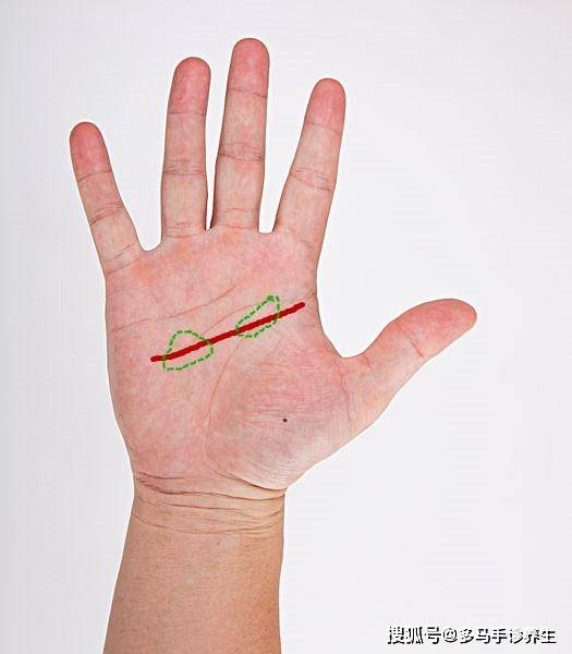 智慧线感情线掌纹诊断:手掌纹怎么自我诊断病症