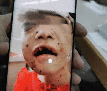 原创4岁女童长期遭禽兽继母非人虐待，重伤后ICU仍在抢救，央视新闻愤怒发声