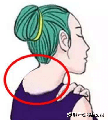 怎么样看自己有没有富贵包 dc308337f1bc46588ce25eb3138496ef.png