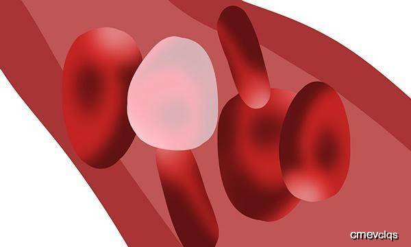 血脂怎么量 e8cdeed96ee441a1bcf202d4c9f92943.jpeg