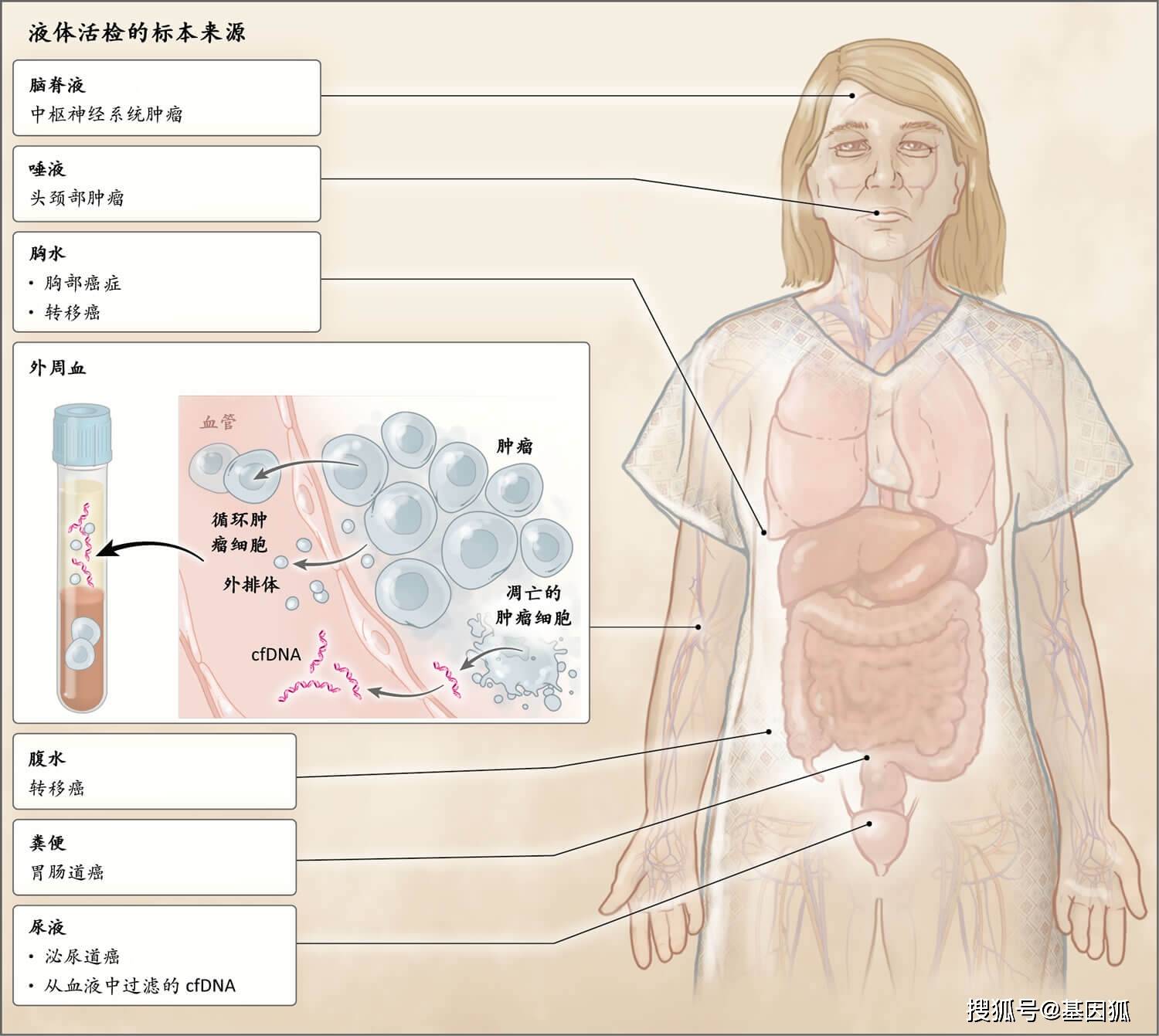 科普 细胞游离dna cell free dna cfdna 基本知识简介 临床