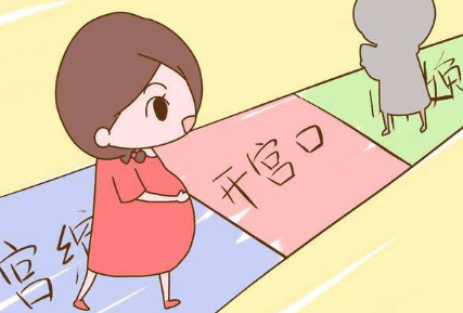 开宫口是什么感觉?