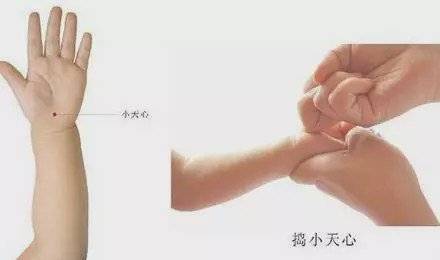小儿|捏积派——孩子受到惊吓、哭闹不安?小儿推拿帮宝宝镇惊安神!