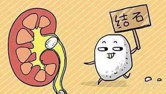 日常生活中如何预防肾结石1,服用药物要注意女性服用养生药品时要注意