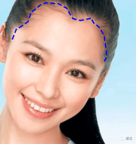 虞书欣不是才24岁吗?怎么就秃成这样了…