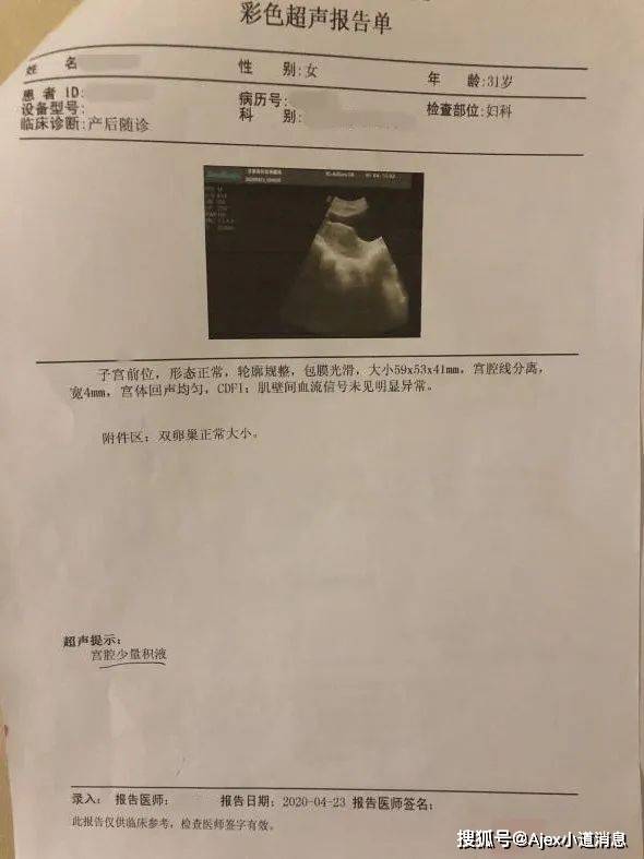 腹直肌分离,屁股变大可以恢复吗?