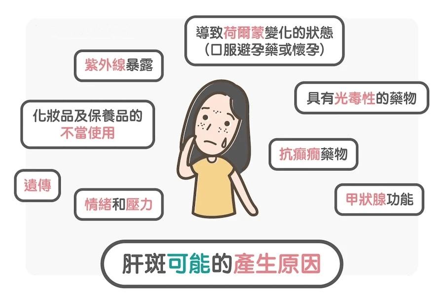 公立名医告诉你黄褐斑该如何正确治疗?