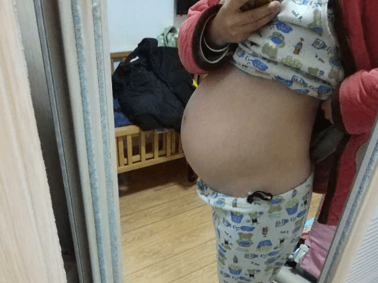 肚子脂肪厚度 48fd8f77acfd41b597f9e421dee76931.png
