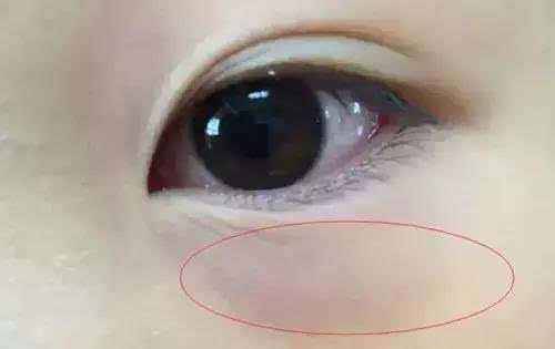 宝宝|说明宝宝已经脾胃差了，妈妈们不能看不见出现4种表现