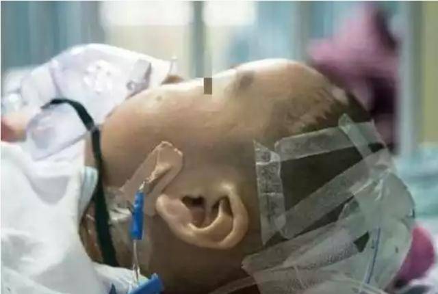 孩子|只因奶奶用老方法哄睡，家长要引以为戒1岁健康宝宝脑出血