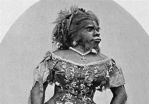 原创她被称为史上最丑女人,出生时世界瞩目,死后作为标本展出150年