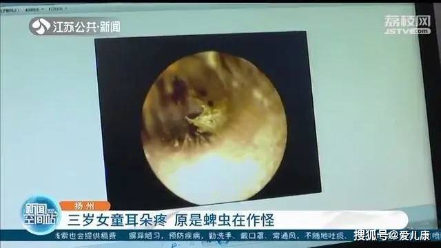 脖子|3岁女宝脖子多个小黑点！家长仔细一瞅，魂都吓掉了……油菜花里转一圈