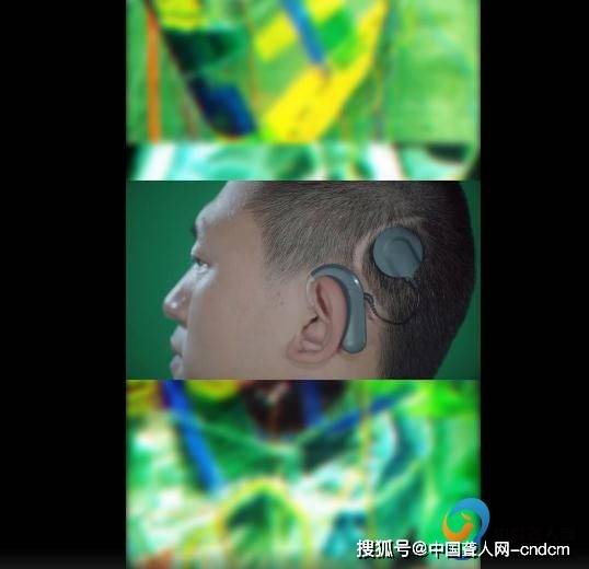 《鲁冰花》的一段自然音频,然后画面显示人站在透明罩中,提示佩戴耳蜗