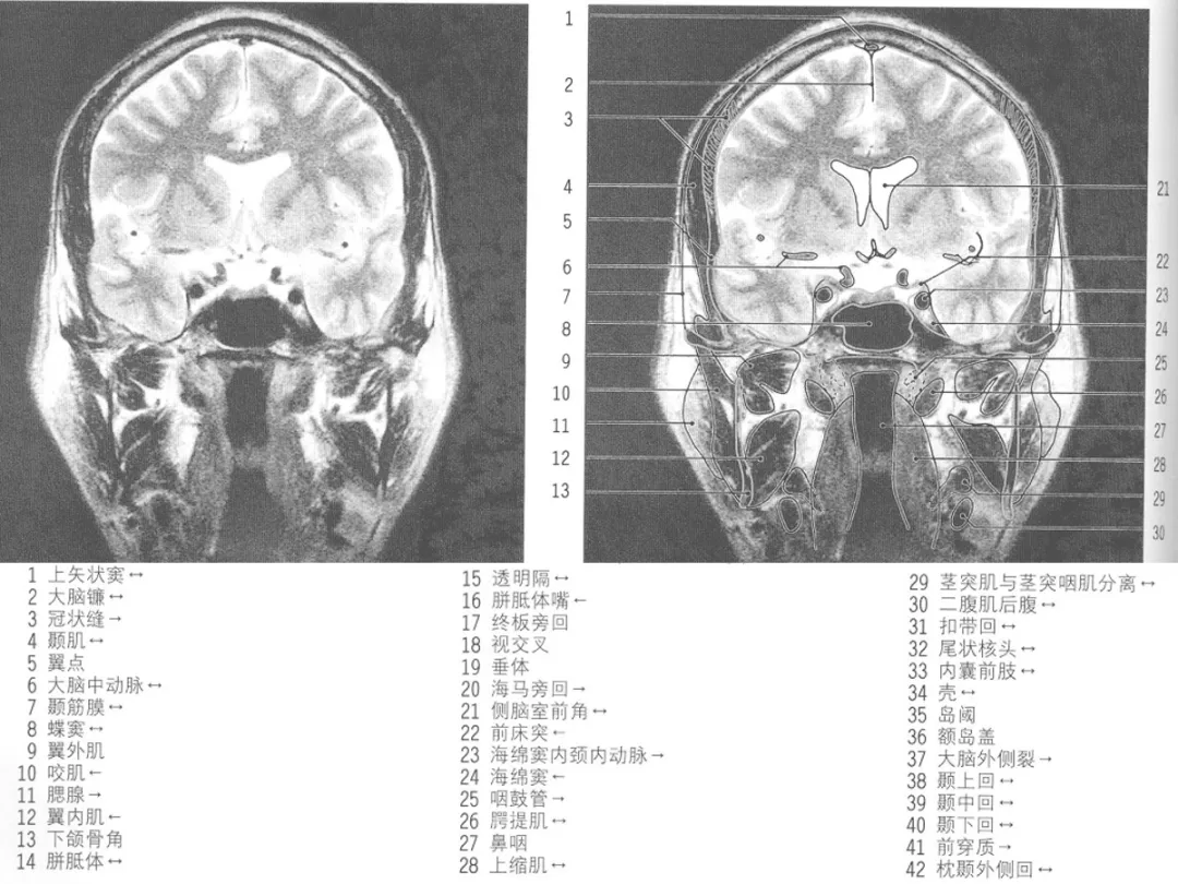 e2bf4a0327d641409029e3e705845d3f.png