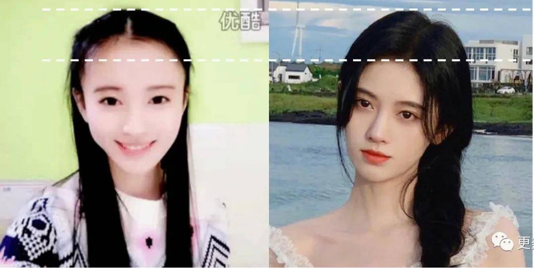 在线|发量王者鞠婧祎在线教你换头！2.5亿脱发少女有救了！