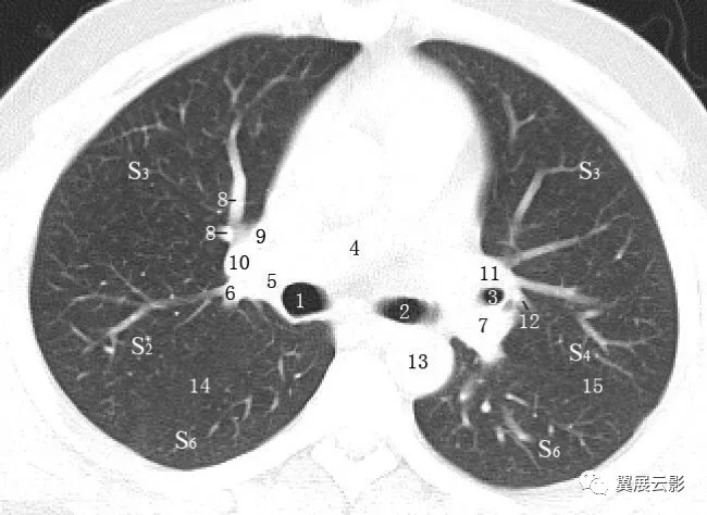 后段动脉 11.前段动脉 10.后段动脉 9.上叶动脉 8.前段动脉 7.