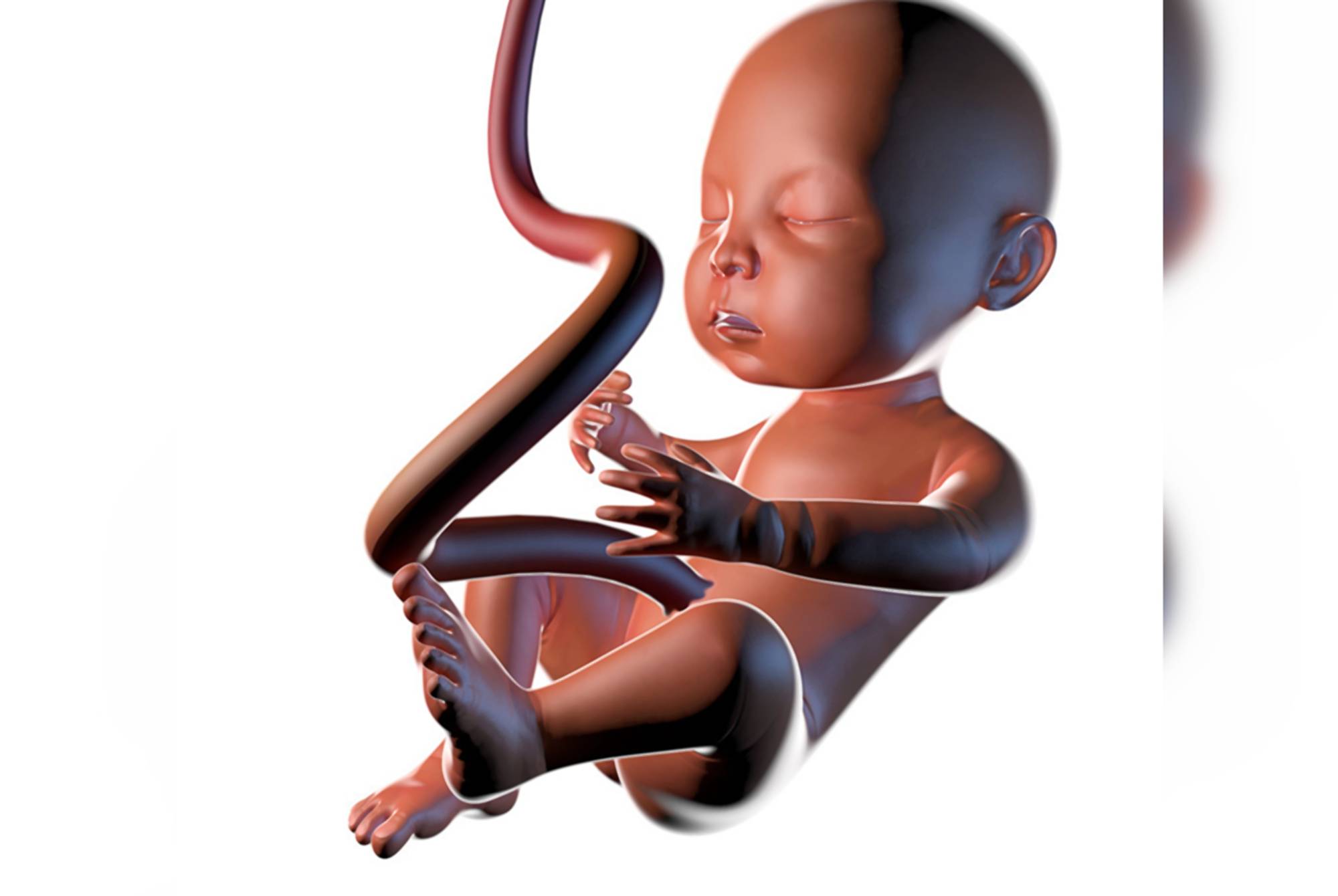 双胞胎孕妈终于“扳回一城”：脐带绕颈概率低，单胎孕妈羡慕不来