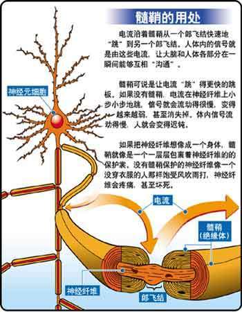 脱髓鞘疾病病理特征与变化_神经细胞