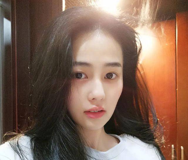 颧骨|王嘉尔变成牙套脸?颧骨外扩太阳穴也凹陷,太多明星因此颜值骤降