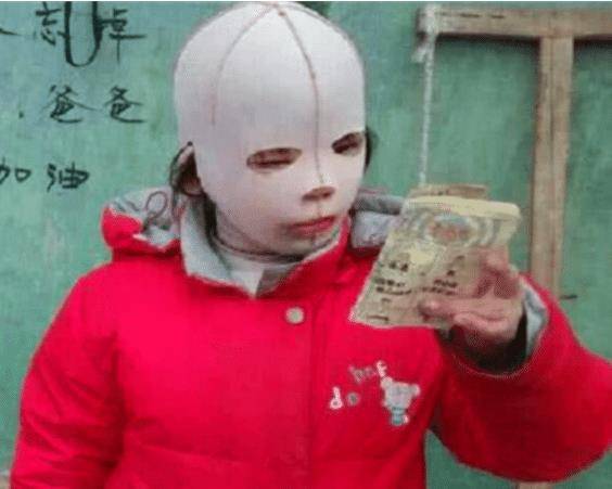 原创女孩因为一直戴头套上学，被同学疯狂嘲笑，把头套摘下后大家都沉默了