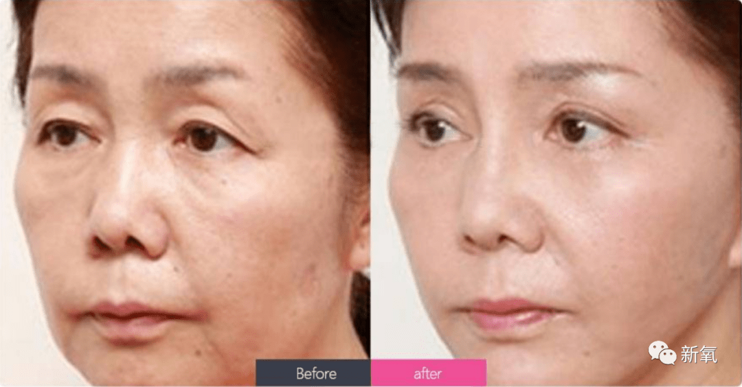 洪欣|这四位大花竟然罕见同框比美了?可她真的被衬得有点脸崩了...