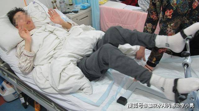 小脑上蚓部动静脉畸形出血术后致颅内感染意识丧失,不能言语,身体木僵