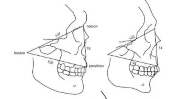 尤物|顶级美艳尤物都是清一色梯型侧颜骨相?
