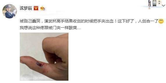 杜海涛|原创沈梦辰晒大腿淤青照，杨迪火速关切询问，杜海涛良久未现身引调侃
