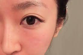 肌肤|不要被美白冲昏了头，夏季才是稳固年轻态的制胜关键