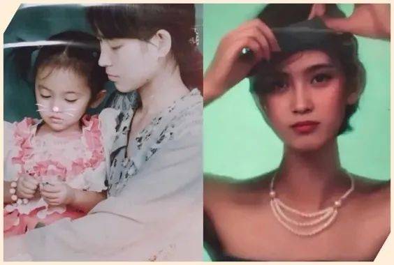 双眼皮|景甜整容整成了“悲伤蛙”，还有比这更悲伤的吗？