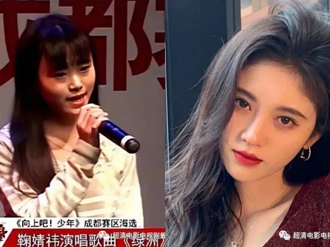 双眼皮|景甜整容整成了“悲伤蛙”，还有比这更悲伤的吗？