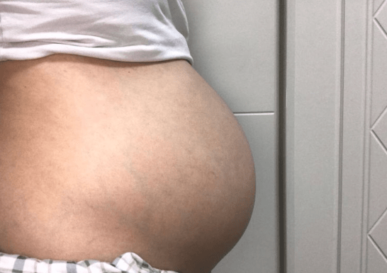 “孕期饮食很清淡，为何还会便秘？”孕期便秘如何预防？
